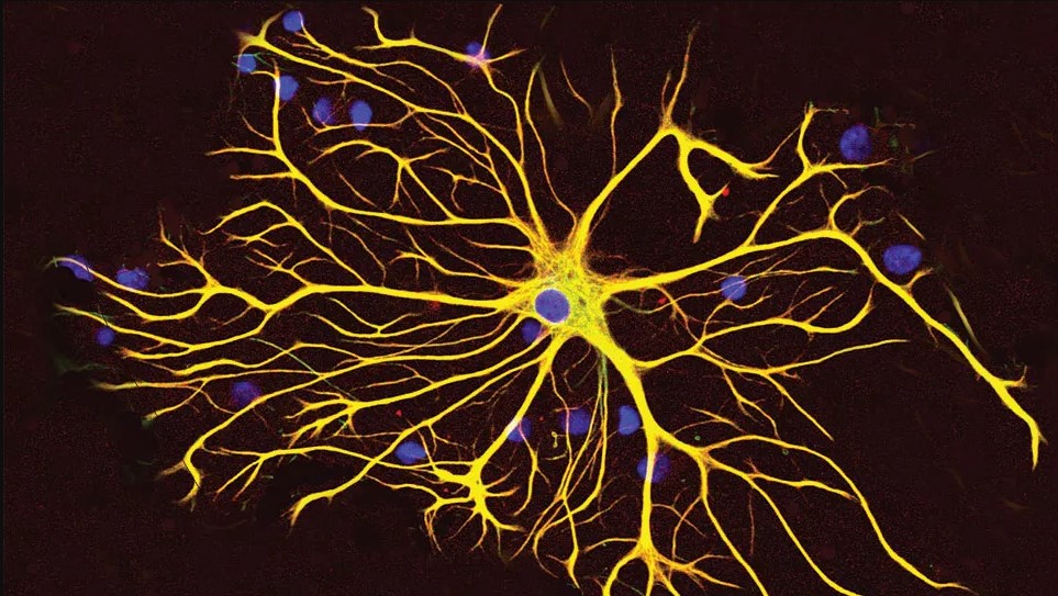 An AI That Reads Brain Tumour Slides Better Than Specialists — In 12&nbsp;Minutes