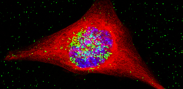 Tiny Balls, Big Problems: How SNAs Are Sneaking Past the Brain’s Defences